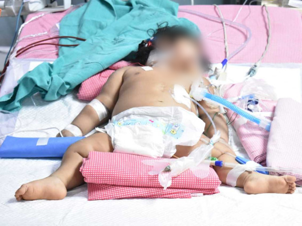 9 months old ANJANEYA DEVANSH fight Chronic lung disease, Sepsis-septic shock, Acute Kidney Injury, Acute Liver Injury, DIC, Cardiac arrhythmia