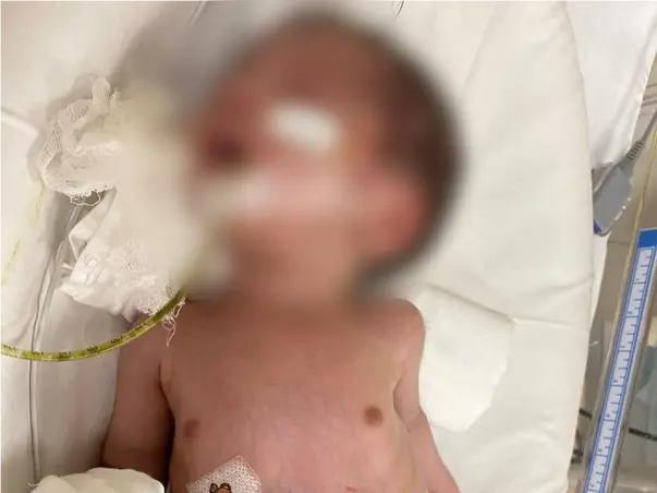 Support Baby of Nitesh fight/recover from ileal atresia