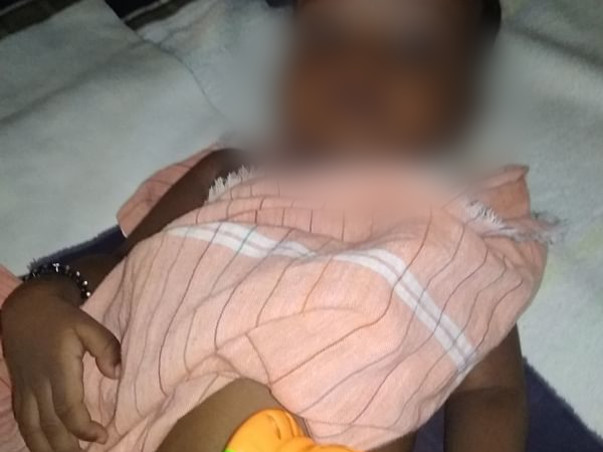 6 Months Old Vishwa Needs Your Help Fight Total Anomalous Pulmonary Venous Return (Tapvr) And Heart Hole