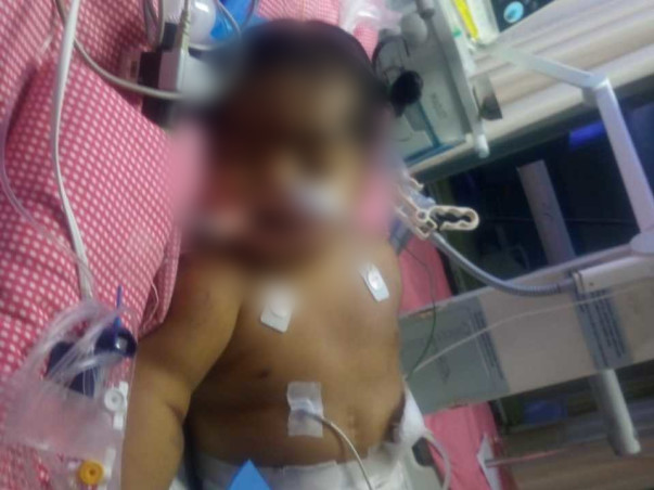 9 months old ANJANEYA DEVANSH fight Chronic lung disease, Sepsis-septic shock, Acute Kidney Injury, Acute Liver Injury, DIC, Cardiac arrhythmia