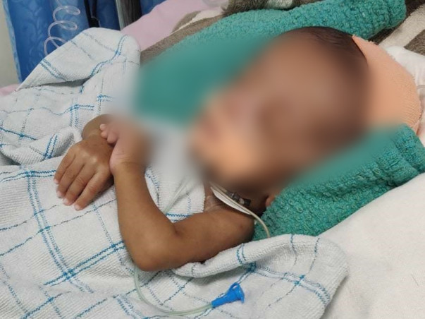 This 6-Month-Old's Head Is Swelling Dangerously, Needs Help