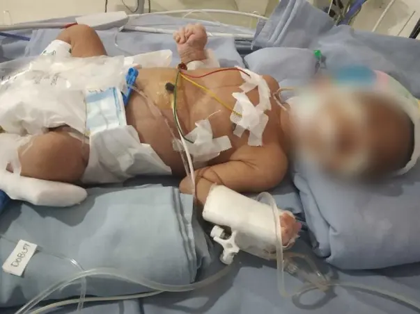 Help my 11-days-old son needs your help fight Terma/Aga, Respiratory Distress, Birth Asphyxia