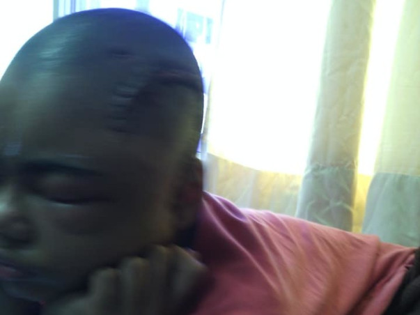 HELP PRASANNA FIGHT AGAINST EPILEPSY