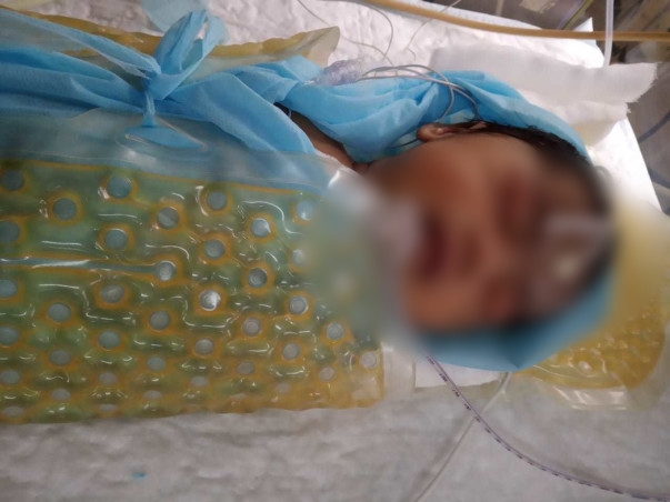 Support Baby of anusha fight/recover from Perinatal asphyxia