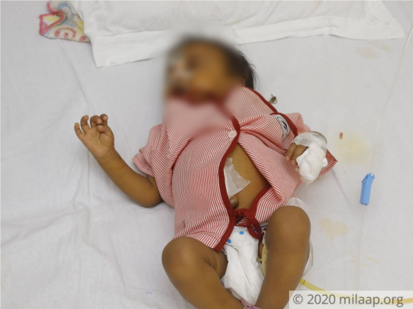 Support little Poorvi fight against metabolic liver failure