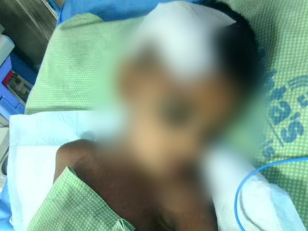 Help Shaheir Undergo Brain Surgery And Recover From Trauma