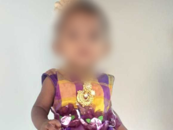 1 Year Old Tejashri Needs Your Help To Recover From Accident