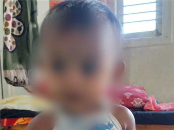 1 Year Old Tejashri Needs Your Help To Recover From Accident
