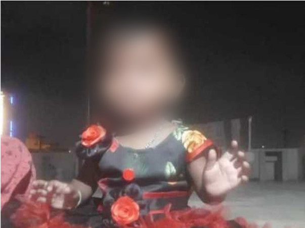 1 Year Old Tejashri Needs Your Help To Recover From Accident