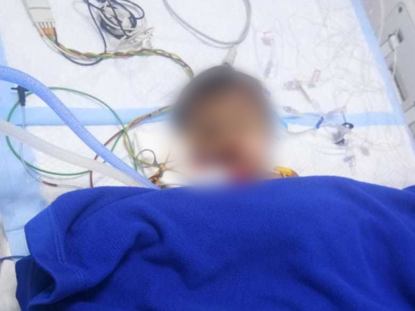 1 Year Old Tejashri Needs Your Help To Recover From Accident