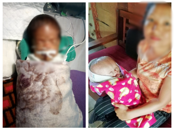 Help Baby Chinghoihcy fight a brain defect (Neural Tube Defect)
