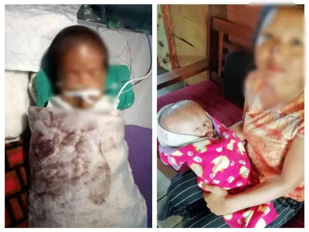 Help Baby Chinghoihcy fight a brain defect (Neural Tube Defect)