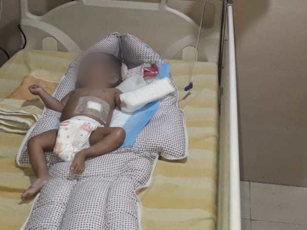 11 Months Old Myasarvin Needs Your Help Fight Hydrocephalus