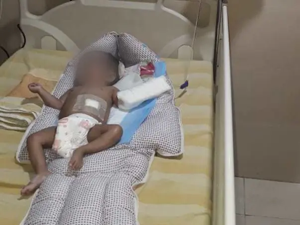 11 Months Old Myasarvin Needs Your Help Fight Hydrocephalus
