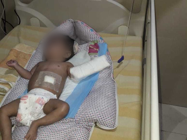 11 Months Old Myasarvin Needs Your Help Fight Hydrocephalus
