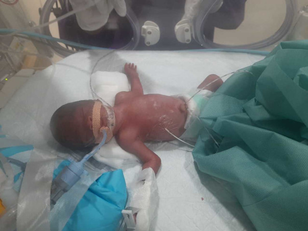 Support Baby Of Sophia Recover From Preterm Birth