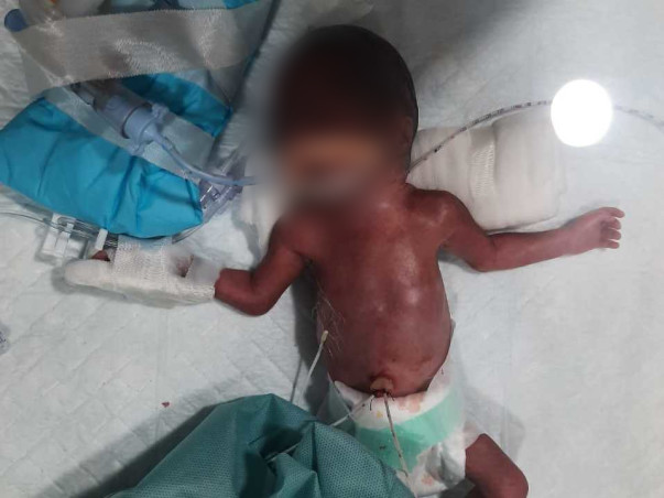 Support Baby Of Sophia Recover From Preterm Birth