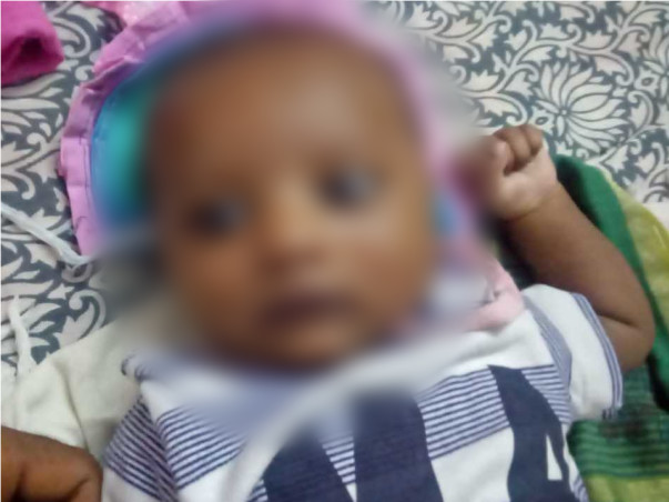 My 2 month old baby needs an urgent Heart Surgery and needs your help