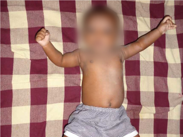 My 2 month old baby needs an urgent Heart Surgery and needs your help