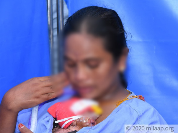 My 8 day old twins are in the ICU and need your support to survive