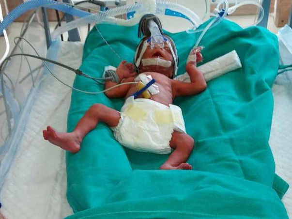 My Twin Babies Needs Your Urgent Support To Undergo NICU Care