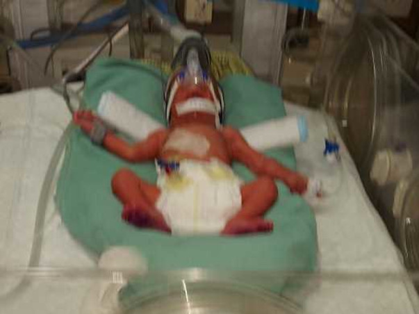 My Twin Babies Needs Your Urgent Support To Undergo NICU Care