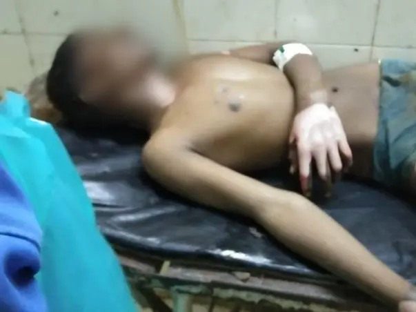 Support Sameer Recover From Electricity Burn