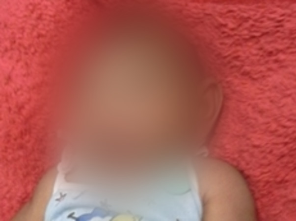 Support Sai Kishore Recover From Midbrain And Cortical Injury