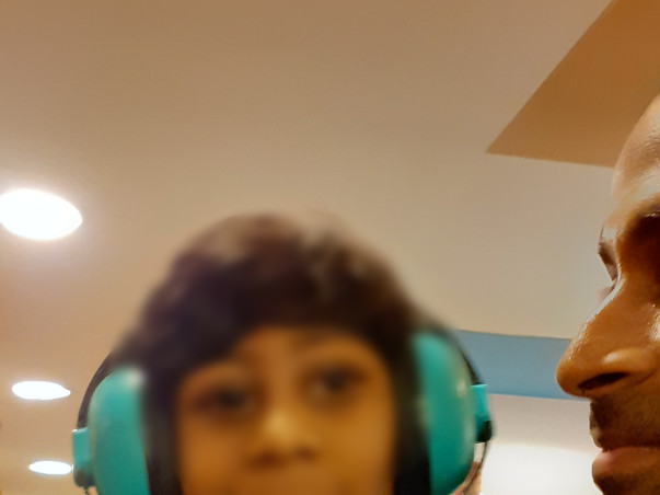 Support Sai Kishore Recover From Midbrain And Cortical Injury