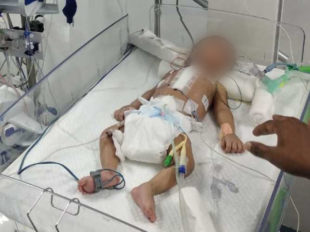 This 1 Month Old Needs Your Urgent Support In Fighting Heart Disease