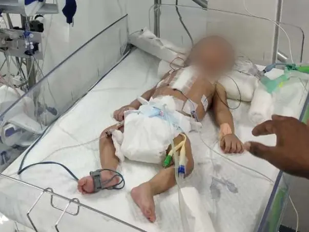 This 1 Month Old Needs Your Urgent Support In Fighting Heart Disease