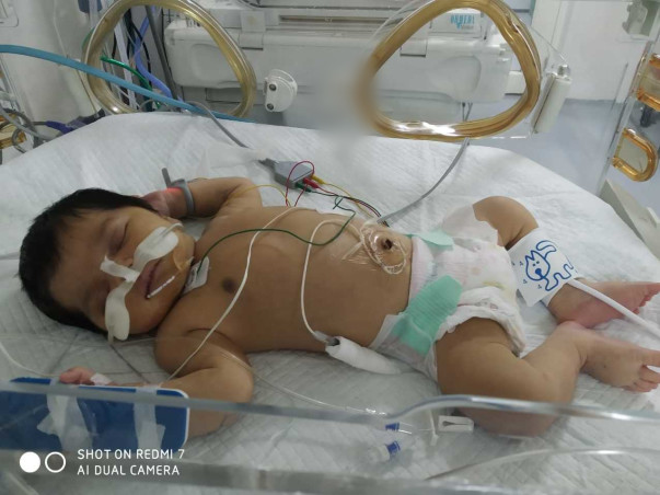 Support Baby Of K Saidevi Recover From Heart Disease