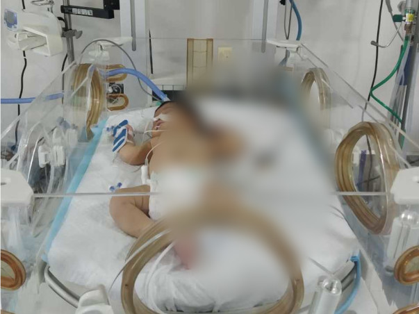 Support Baby Of K Saidevi Recover From Heart Disease