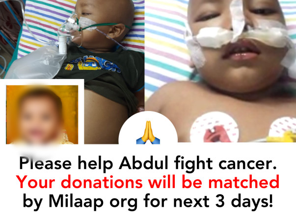 2 yr old kid Abdul needs your help fight cancer. Please save the child