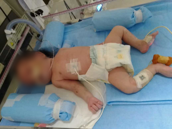 This 28 Days Old Needs Your Urgent Support To Undergo NICU Care