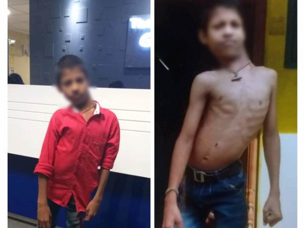 Support Yuvaraj - Spinal Disorder surgery