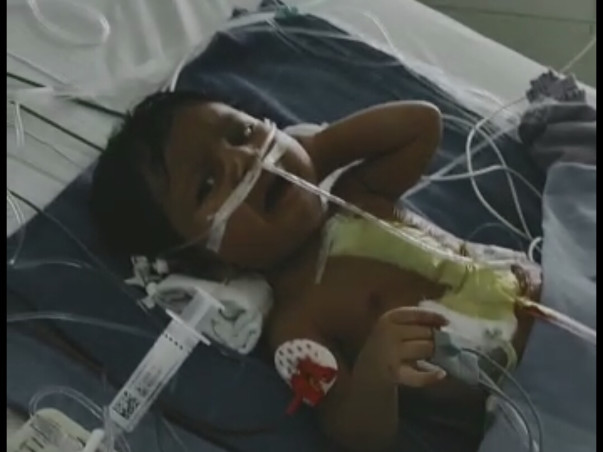 Need ur support on Heart Surgery Expenses & Debts on my 3monthsoldbaby