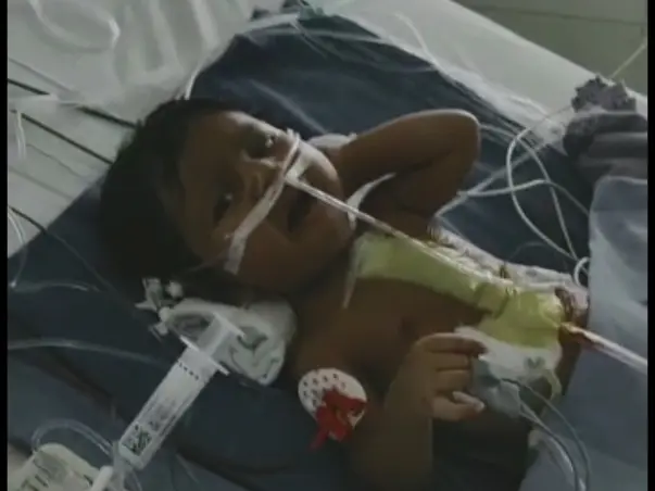 Need ur support on Heart Surgery Expenses & Debts on my 3monthsoldbaby