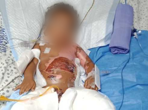 My son is in the ICU battling for his life and needs your help