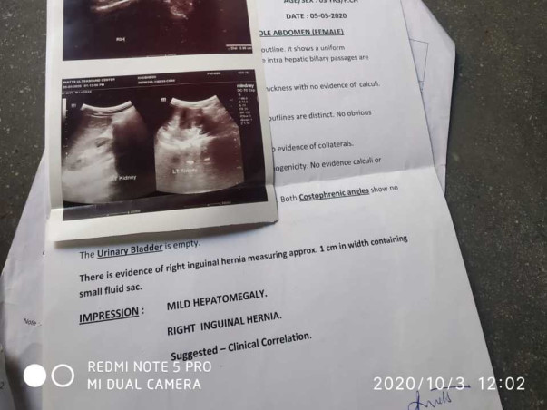 Help khushboo get a surgery for hernia