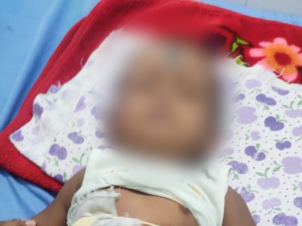 Biswajit phatak.To my friends son USG whole abdomen is very sick pleas