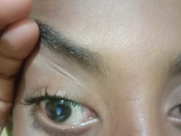 10-Year-Old Orphan Shoib Needs Your Help To Fight Complete Blindness