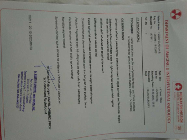 Help 4 Years Old Lakshan Undergo Brain Surgery