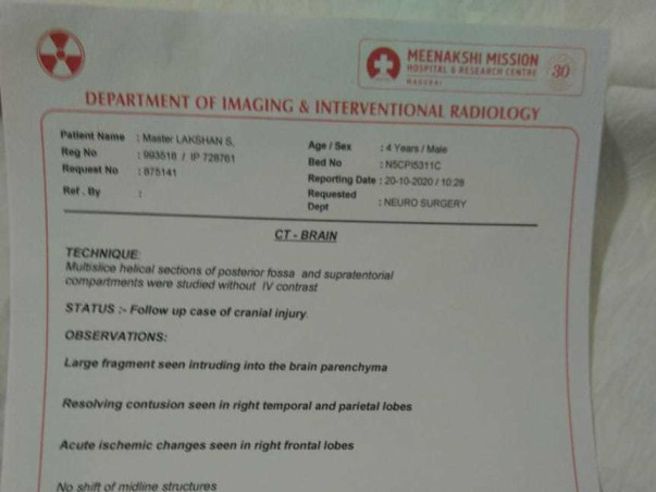 Help 4 Years Old Lakshan Undergo Brain Surgery
