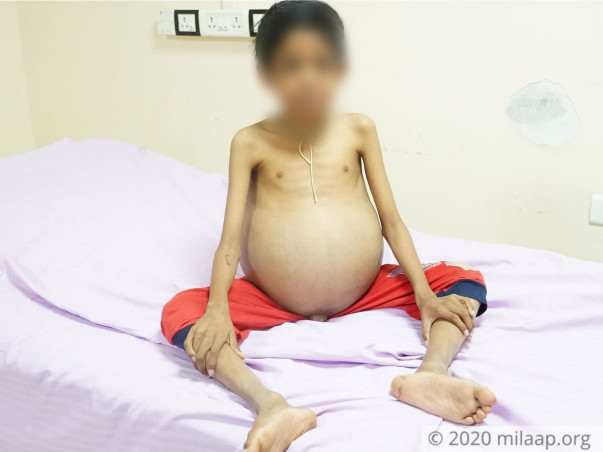 This 9-Year-Old's Stomach Could Burst Any Moment