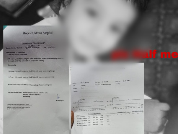 Support Shaik Nufaer Ahilan Recover From Cochlear Implant Surgery