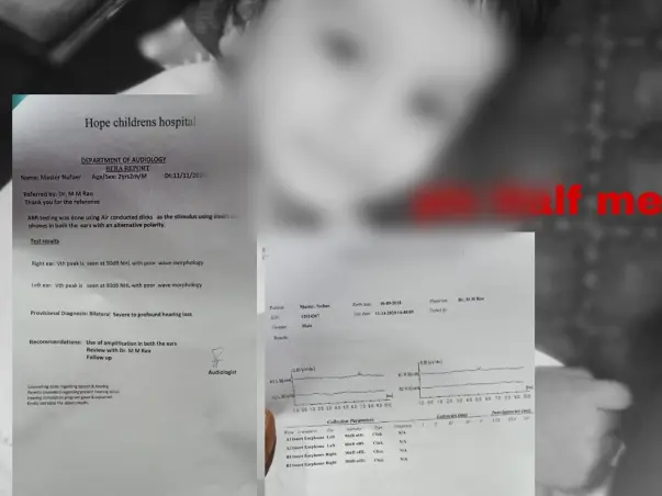 Support Shaik Nufaer Ahilan Recover From Cochlear Implant Surgery