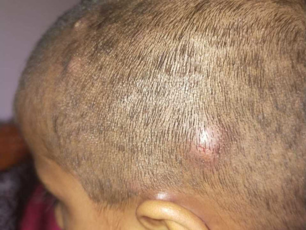 Support Alok Kumar Gowda Recover From Primary Immunodeficiency