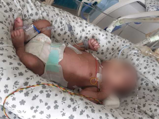 18 Days Old Son Of Surjit Needs Your Help Recover From  Infant Respiratory Distress Syndrome