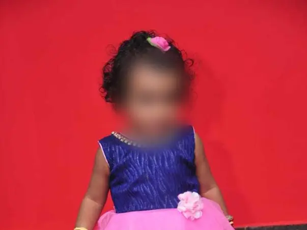 1 Year Old Haasinisri Needs Your Help To Recover From Wilms Tumour